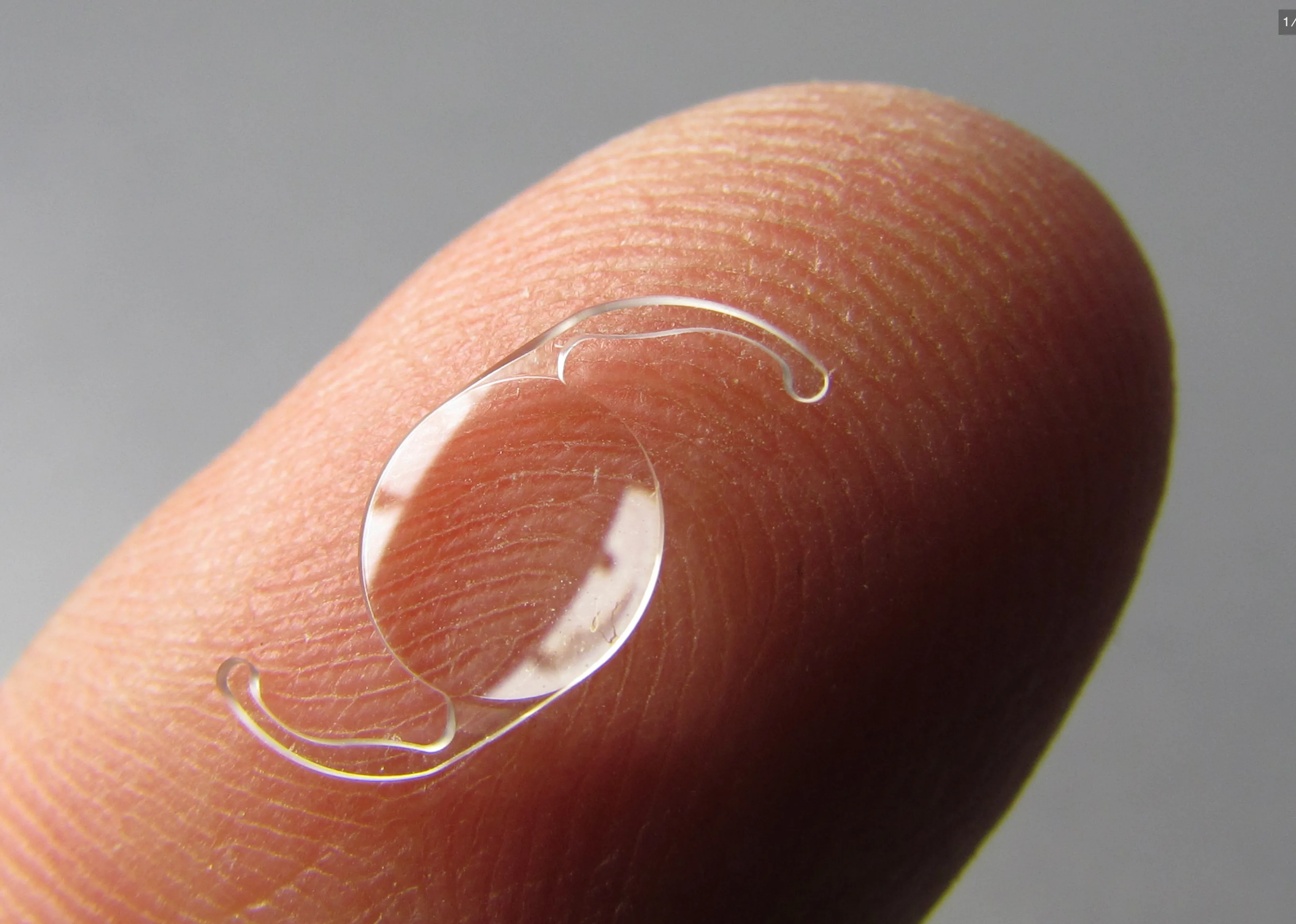 Intraocular lens on a fingertip for scale