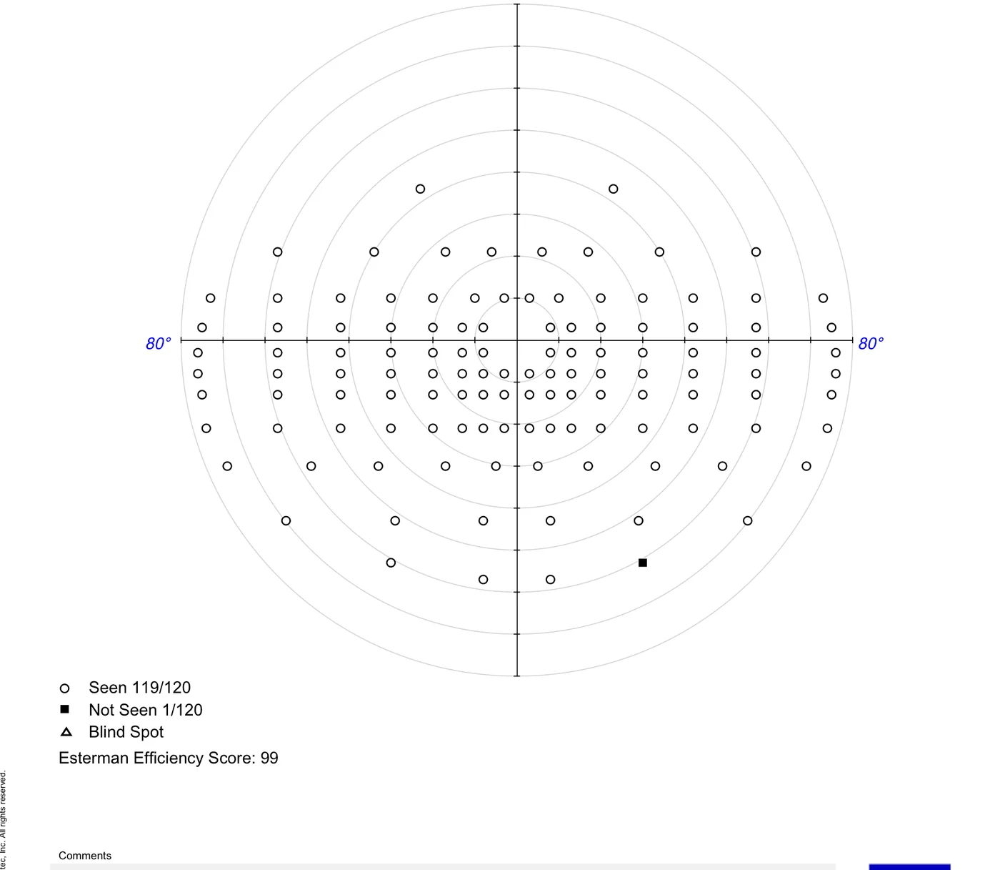 Binocular Esterman visual field test used to assess fitness to drive