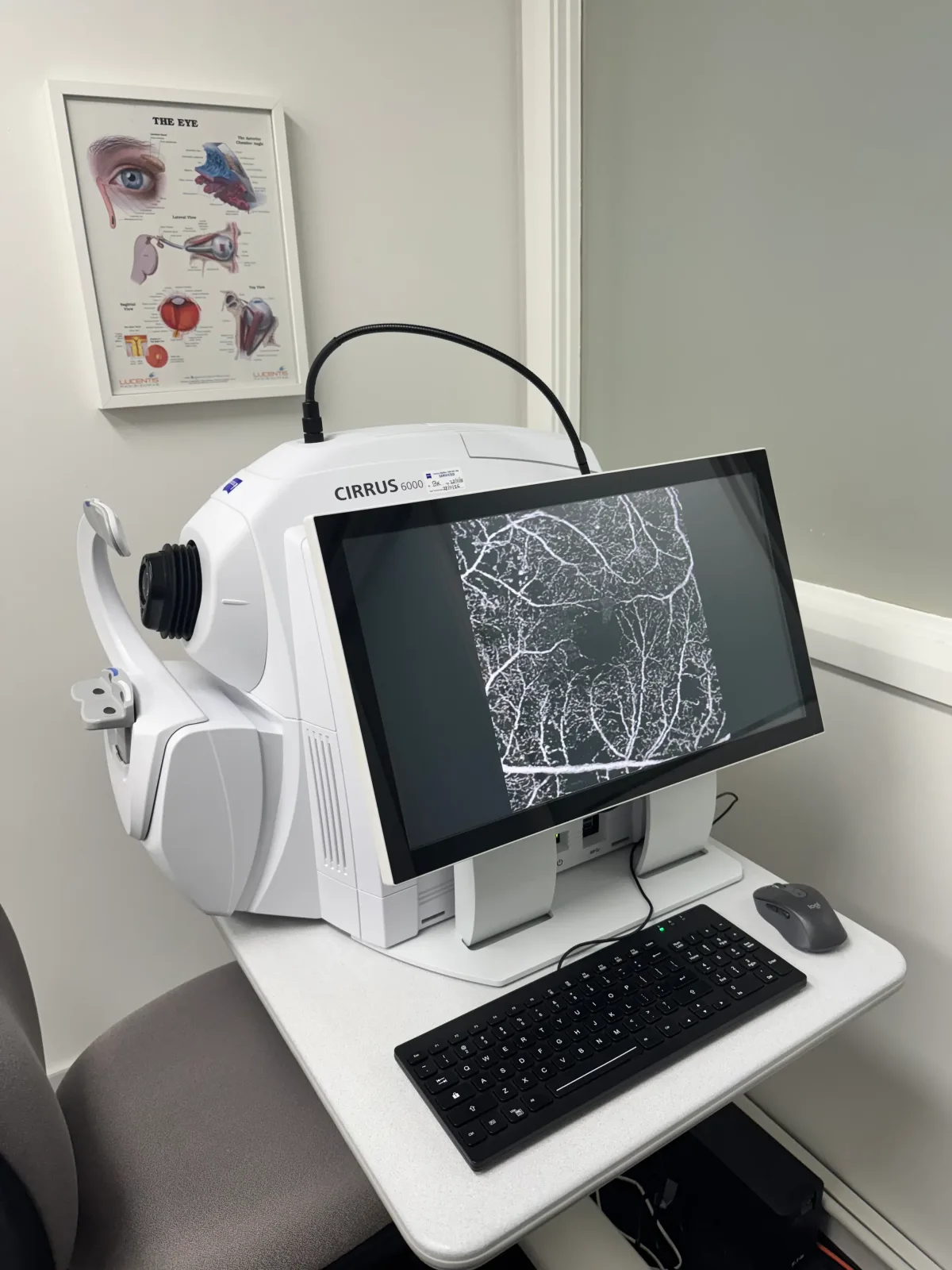 Zeiss Cirrus 6000 OCT with AngioPlex at Eye Surgeons Miranda