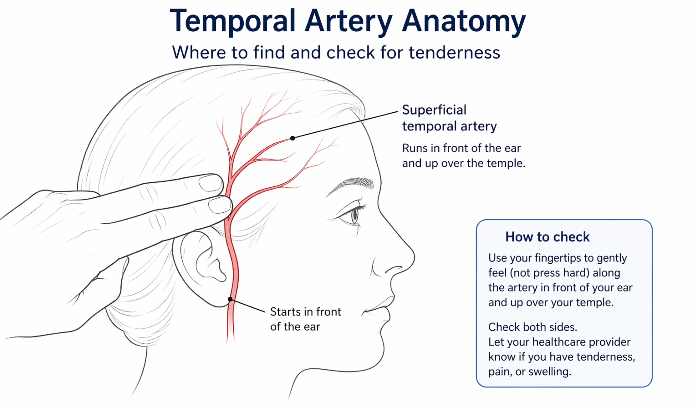Diagram showing the superficial temporal artery running in front of the ear and up over the temple, with instructions on how to gently check for tenderness using the fingertips